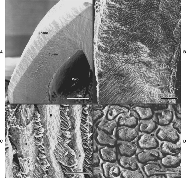 What Is Nano-Hydroxyapatite? A Hygienist Explains Why It’s Becoming a Modern Alternative for Sensitive Teeth