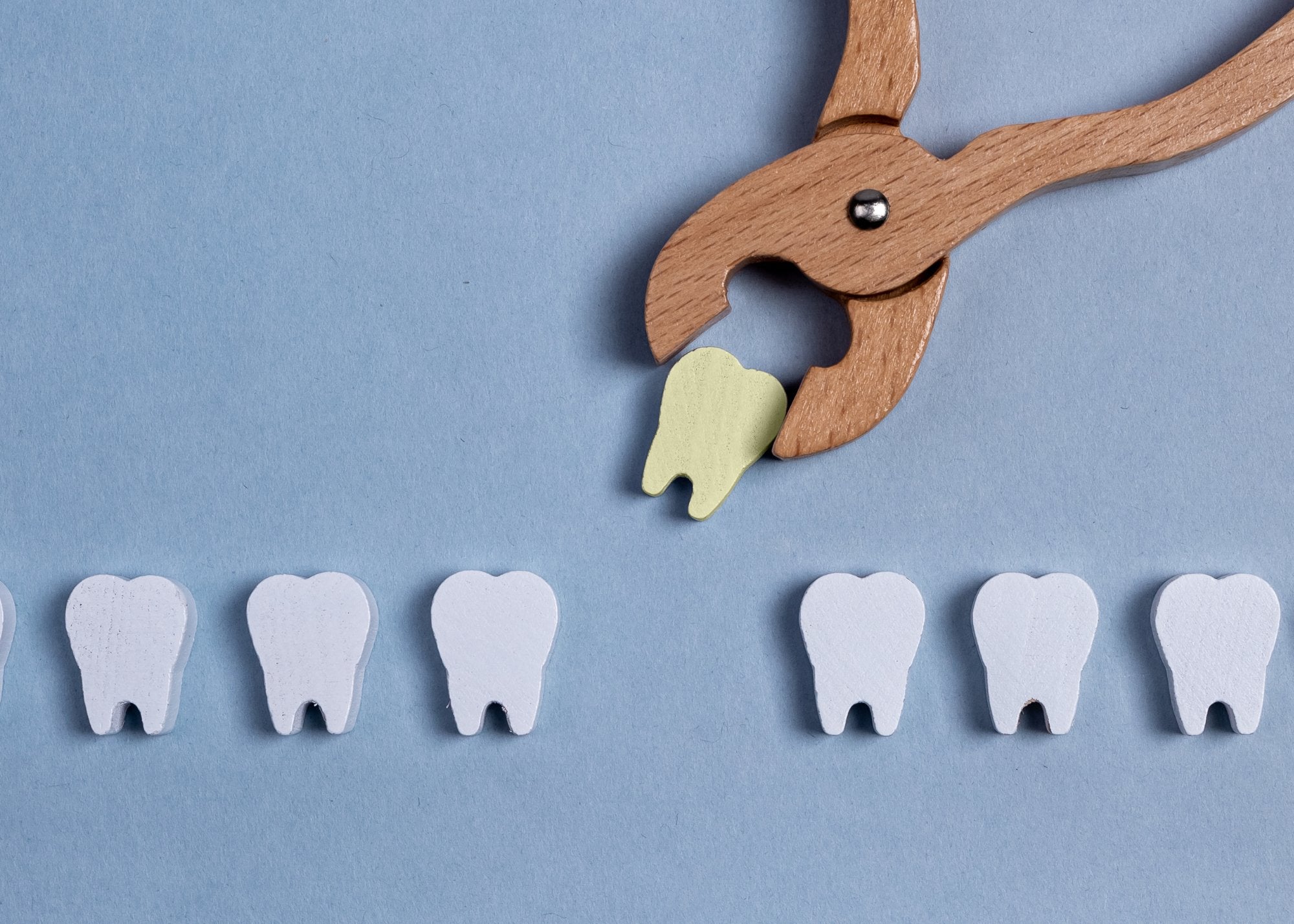 3 Reasons you cannot Whiten your teeth After Tooth Extraction - MySmile