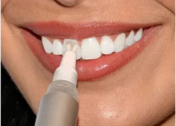 expired teeth whitening gel