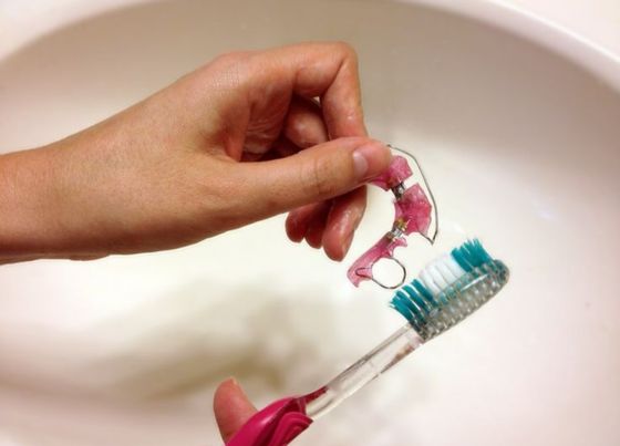 DIY Retainer Cleaner for Hawley, Metal, and Invisalign Retainers