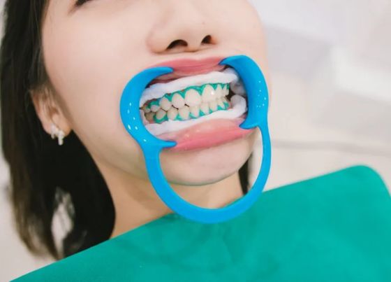 does sliva ruin teeth whitening gel