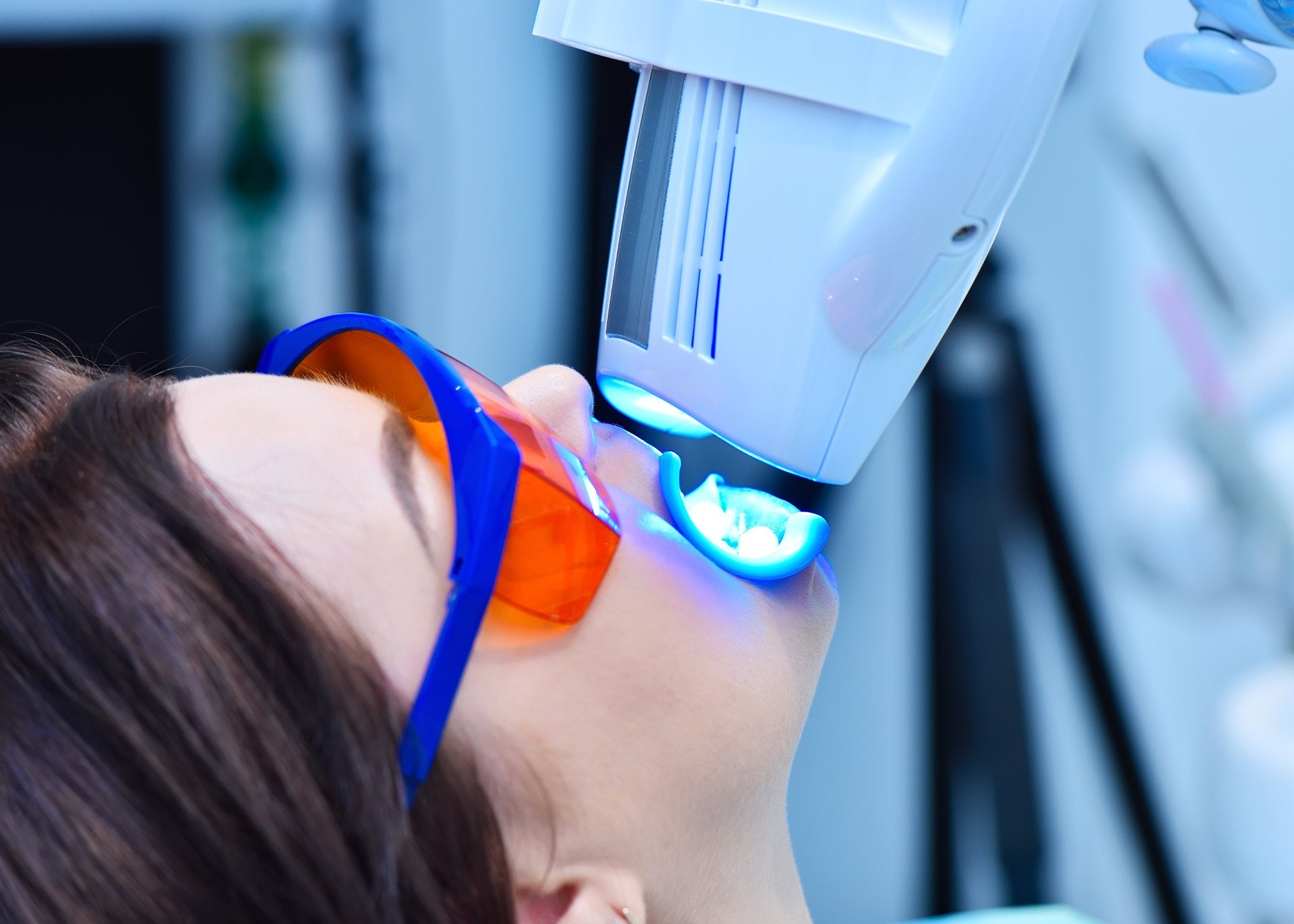 How Long Does Teeth Whitening Last? - MySmile