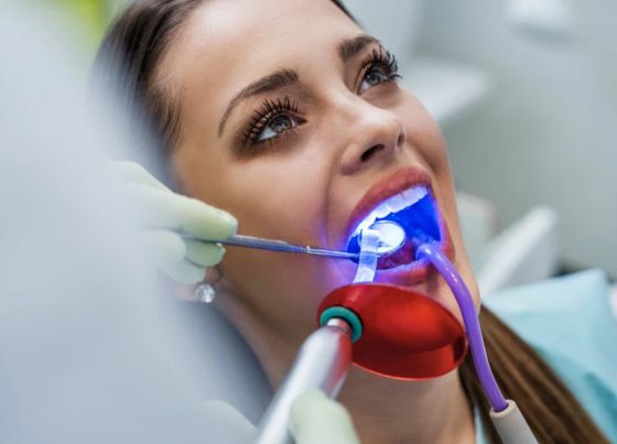 how expensive is teeth whitening