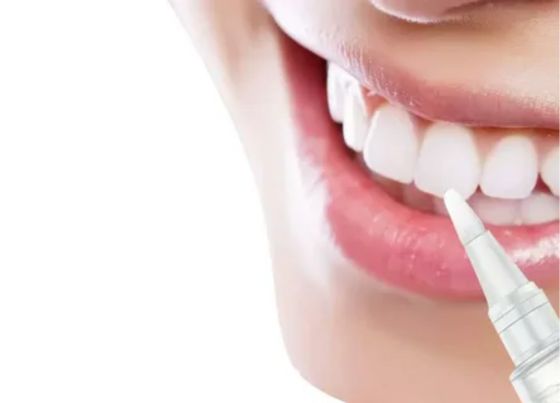 How Long Do Results Last with Teeth Whitening Pens in 2025?