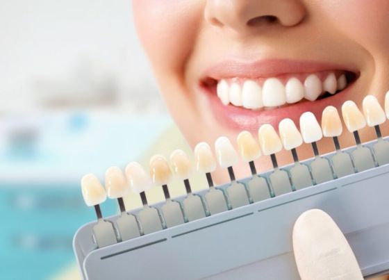 how much does teeth whitening cost