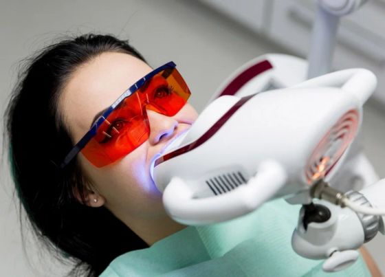 professional vs at home teeth whitening