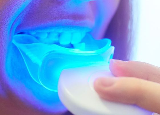 pros and cons of using teeth whitening kits