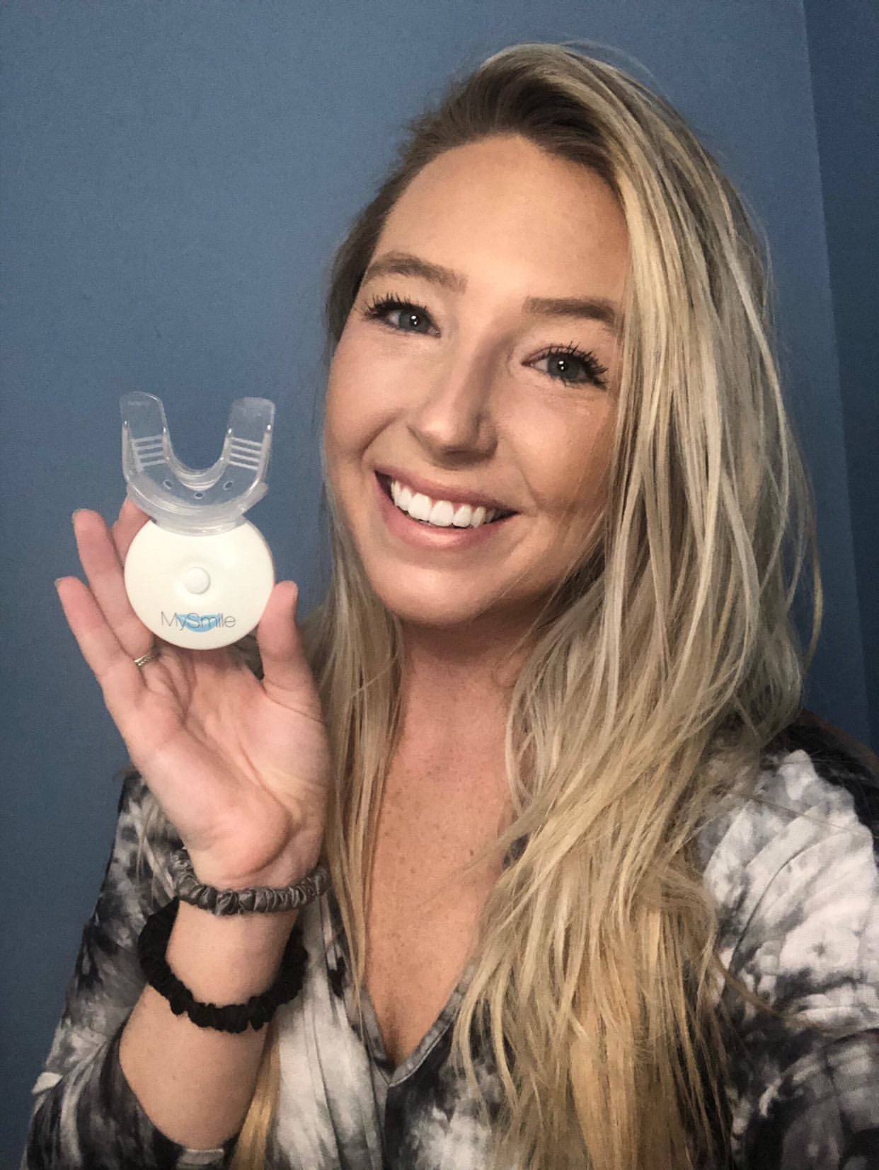 Three Easy Tips For Your Whitest Teeth Yet! - MySmile