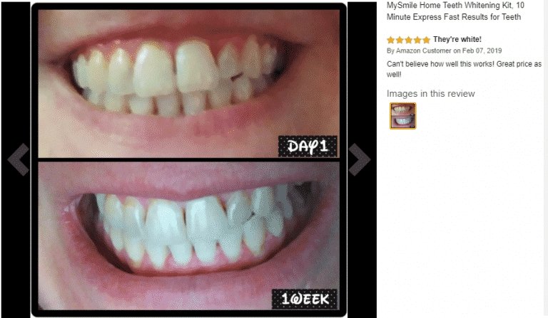Why Choose My Smile? - MySmile