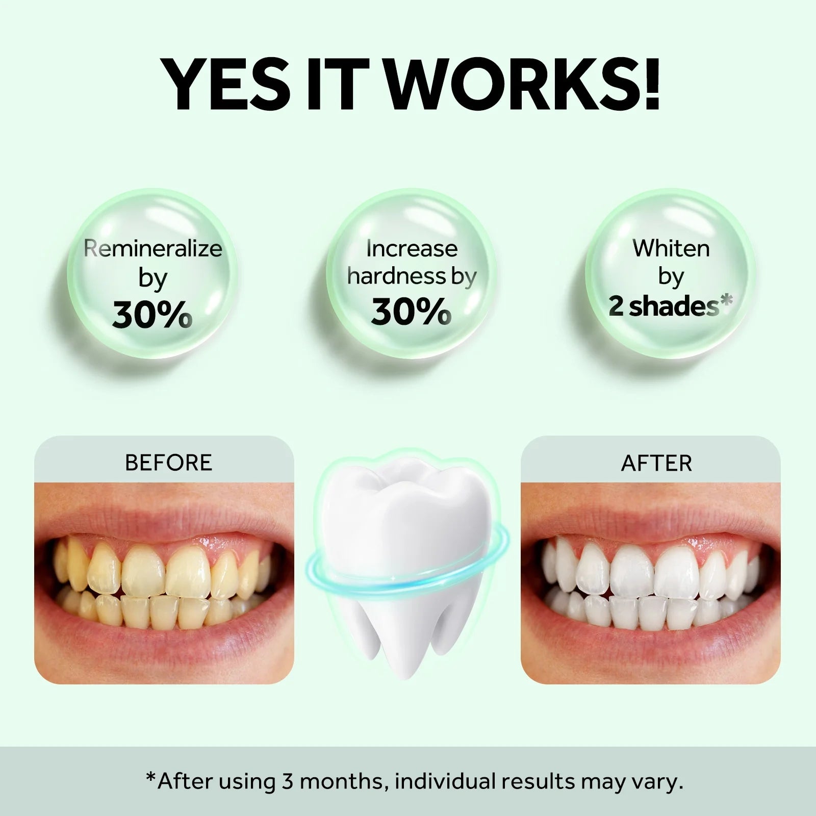 MySmile Nano-Hydroxyapatite Toothpaste