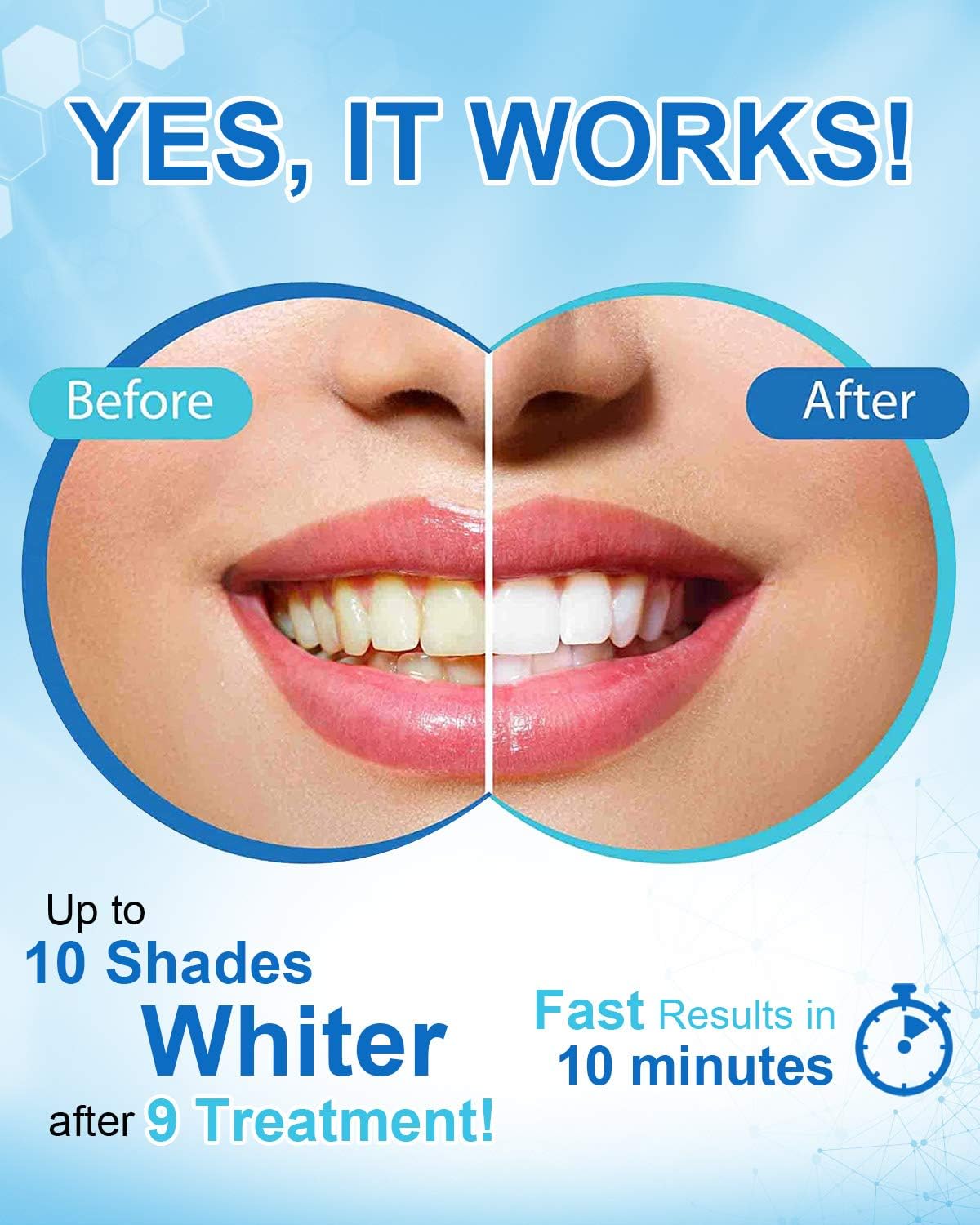 Teeth Whitening Pen w/ 35%CP