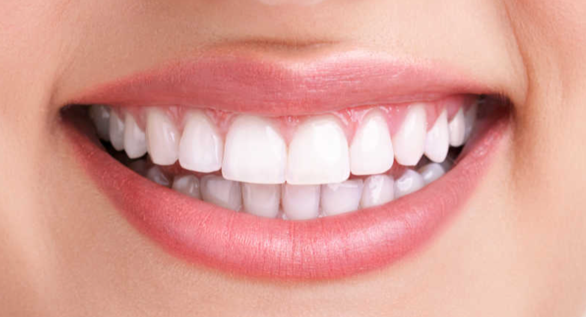 MySmile