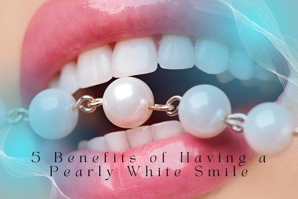 5 Benefits of Having a Pearly White Smile - MySmile