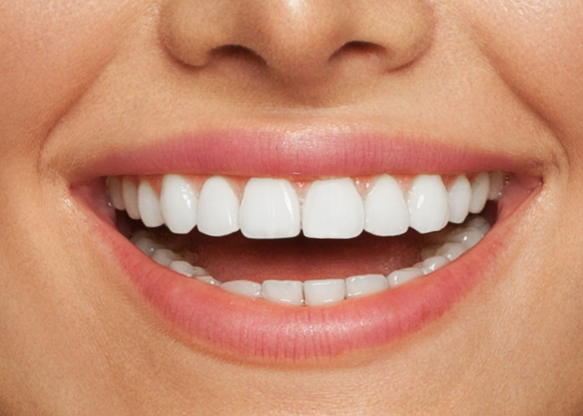 Brighten Your Smile at Home Secrets to Professional Results with an LED Teeth Whitening Kit