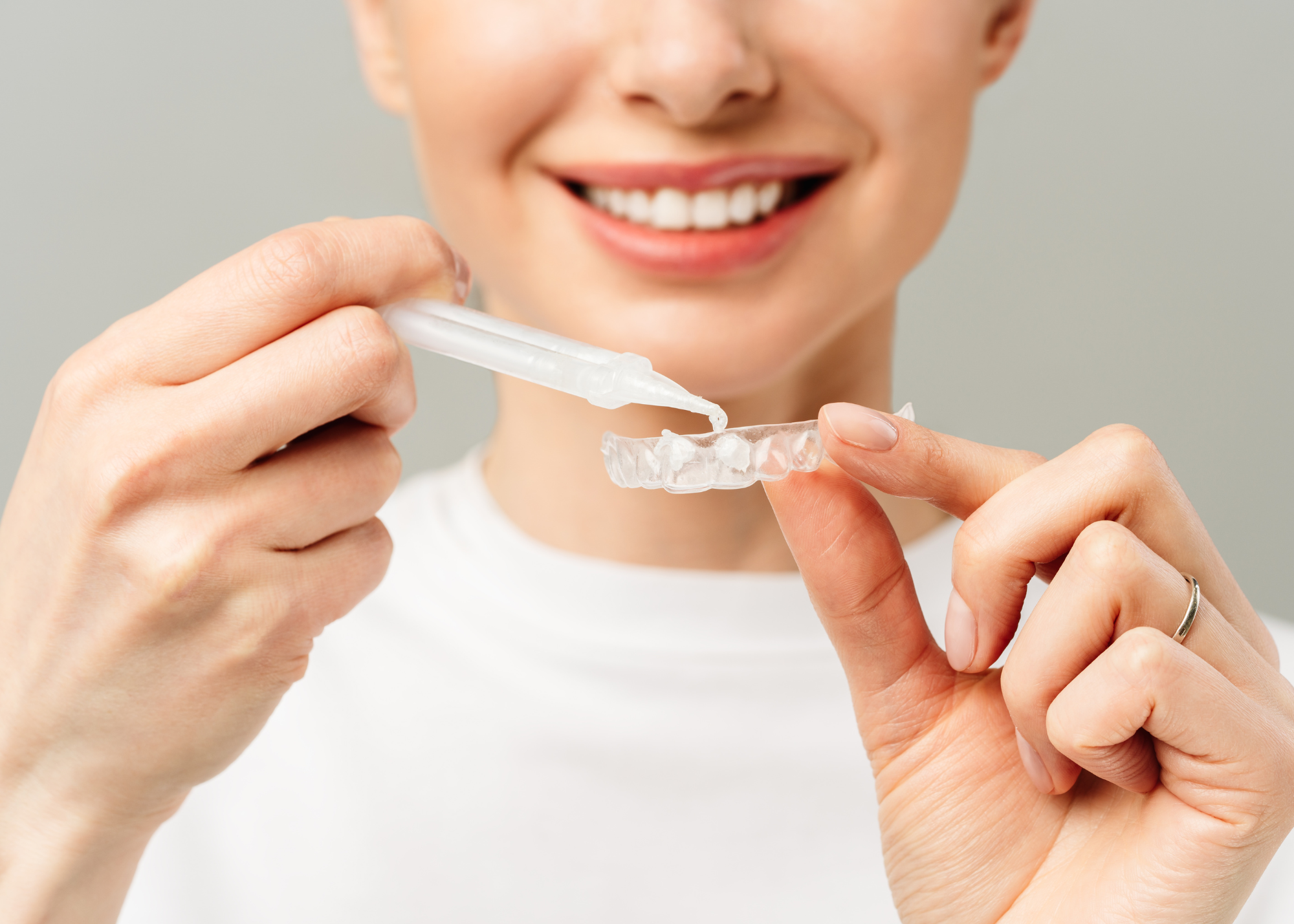 How Safe Is It to Use At-Home Teeth Whitening Gel?