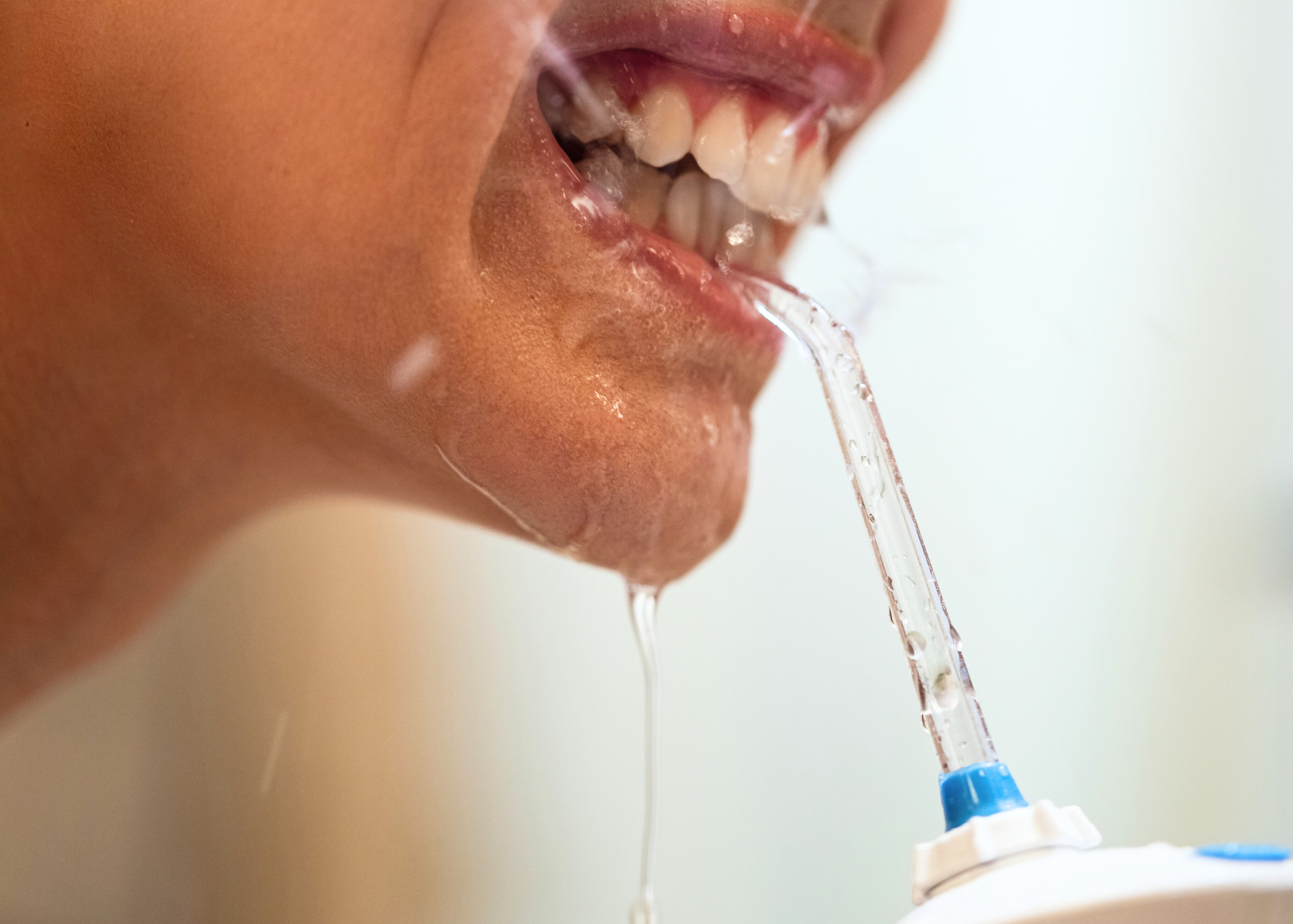 Why dentists prefer water flossers over traditional floss now?