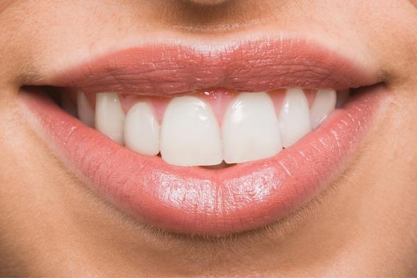 Appropriate Age to Use Teeth Whitening Pen - MySmile
