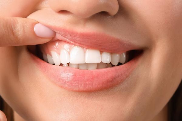 Caring For Your Gums: Tips and Tricks for Healthy Teeth and Gums - MySmile