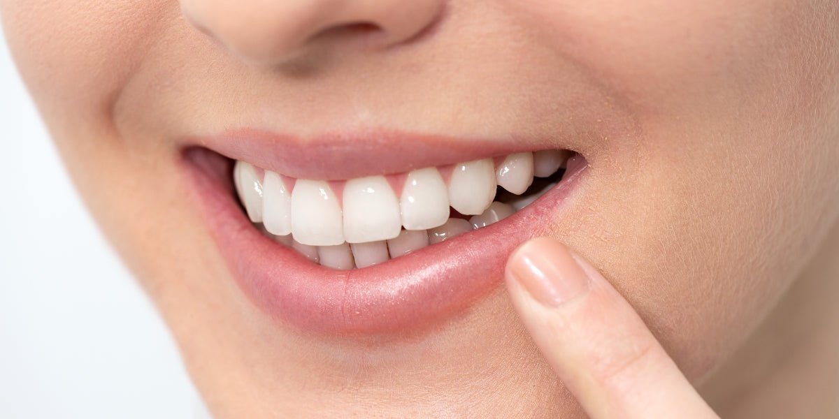 Common Reasons why Teeth Whitening isn’t Working - MySmile