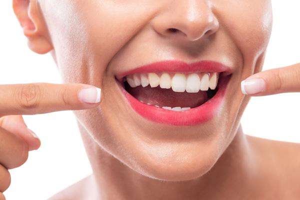 Does Calcium Help to Whiten the Teeth? - MySmile