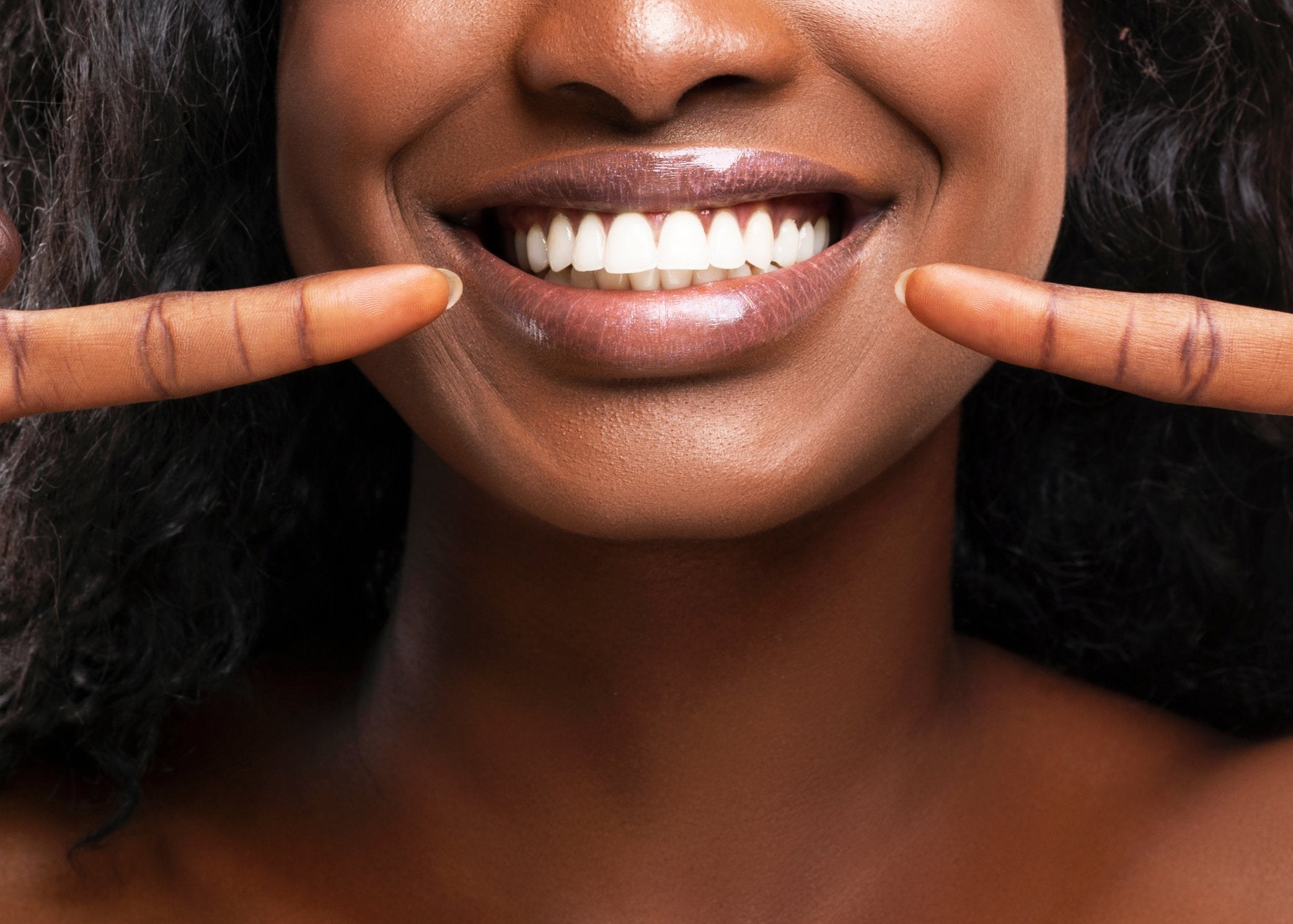 Essential Questions to Ask Before A Teeth Whitening Treatment - MySmile