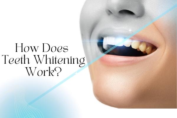 How Does Teeth Whitening Work? - MySmile