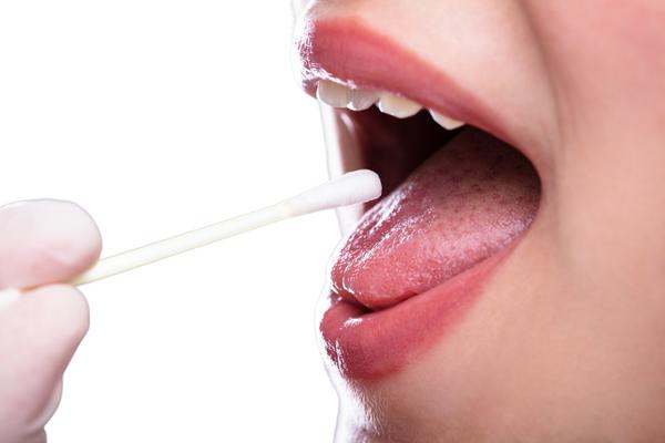 How Medications Affect Saliva Production - MySmile