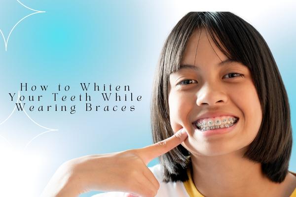 How to Whiten Your Teeth While Wearing Braces - MySmile