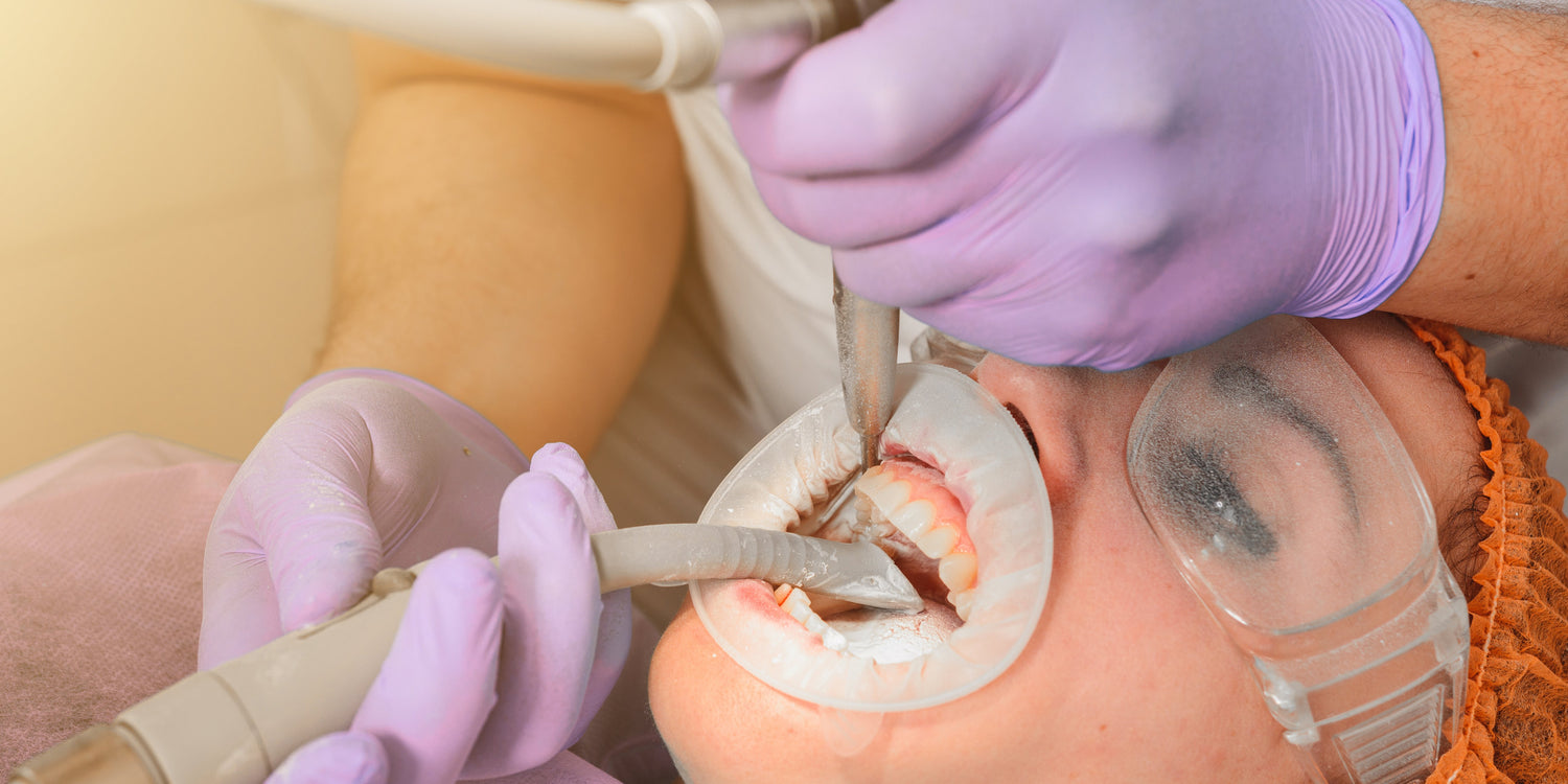 Professional Teeth Cleaning: Removing Plaque and Tartar Buildup - MySmile