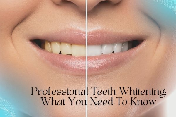 Professional Teeth Whitening: What You Need To Know - MySmile