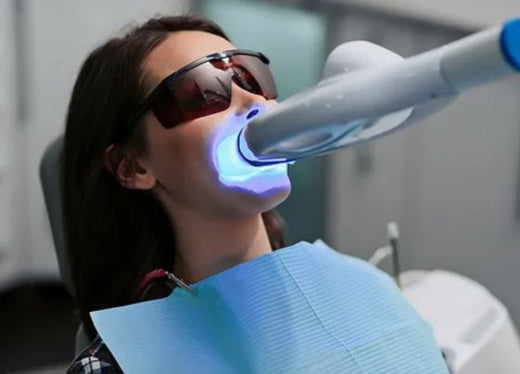 Professional vs. At-Home Teeth Whitening Products