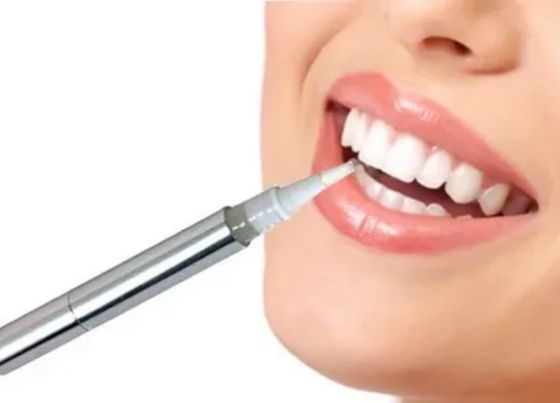 What Are the Safest Teeth Whitening Pens for Sensitive Teeth in 2025?