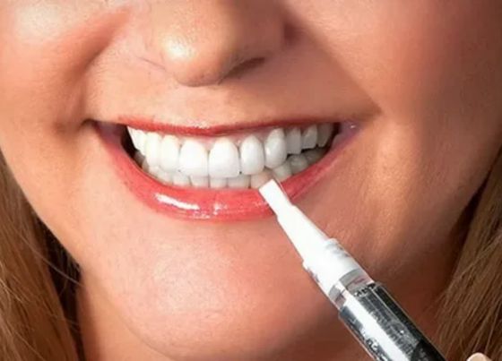 Why Should You Use Teeth Whitening Pens Instead of Strips in 2025?