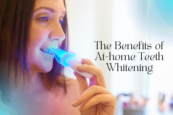The Benefits of At-home Teeth Whitening - MySmile