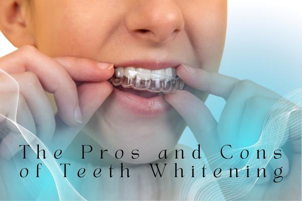 The Pros and Cons of Teeth Whitening - MySmile