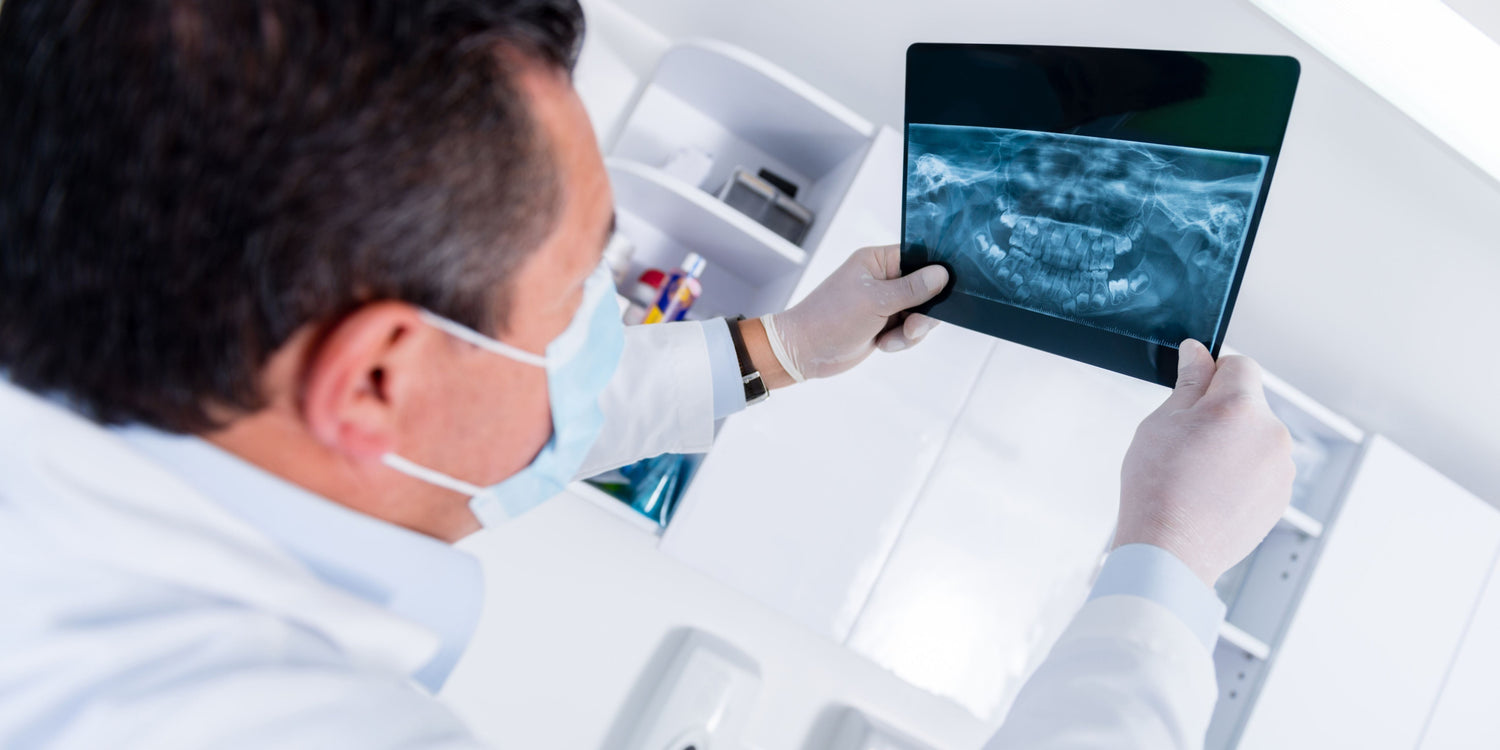 The Truth About Dental X-Rays - MySmile