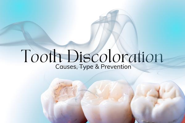 Tooth Discoloration: Causes, Type & Prevention - MySmile