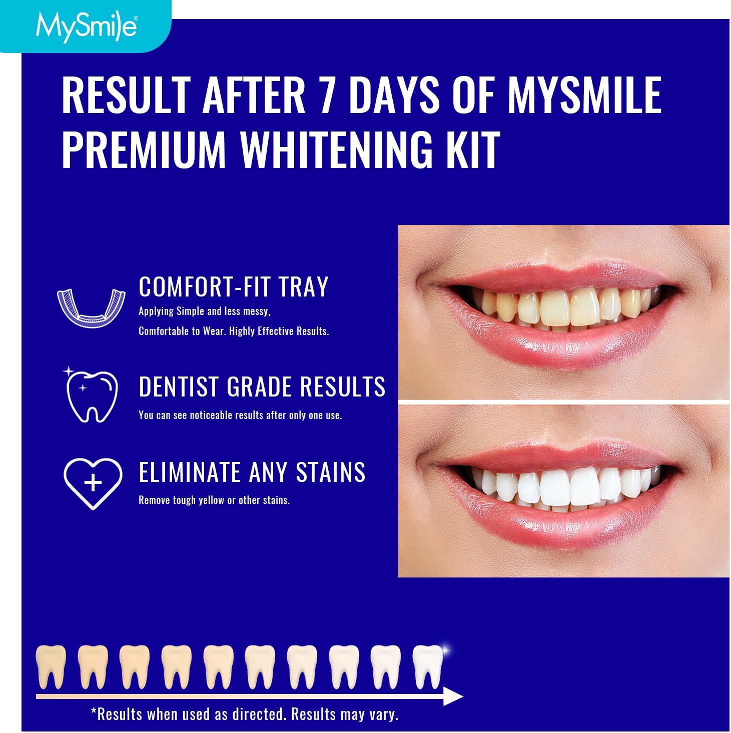 Prefilled Teeth Whitening Trays w/ 12% Hydrogen Peroxide
