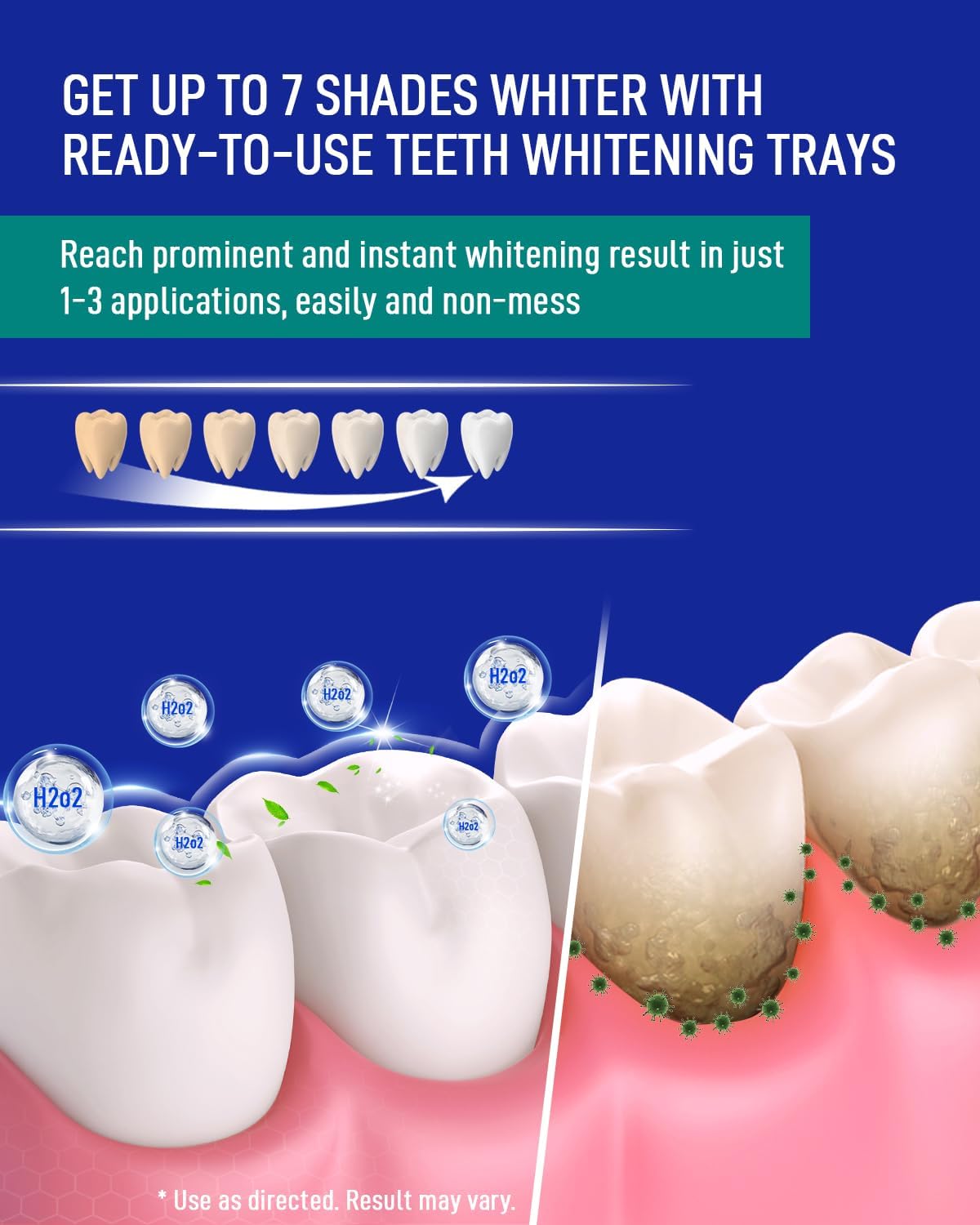 Prefilled Teeth Whitening Trays & Nano-Hydroxyapatite Toothpaste Bundle