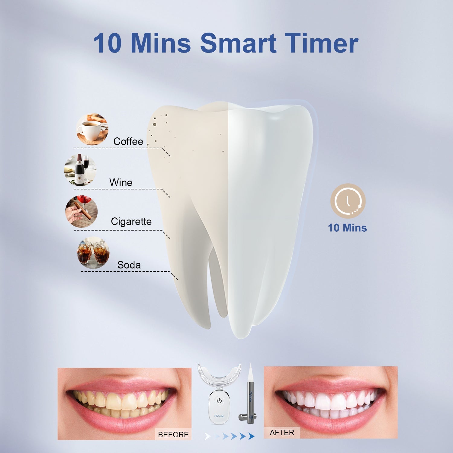 Get Up To 12 Shades Whiter MySmile Teeth Whitening Kit Best