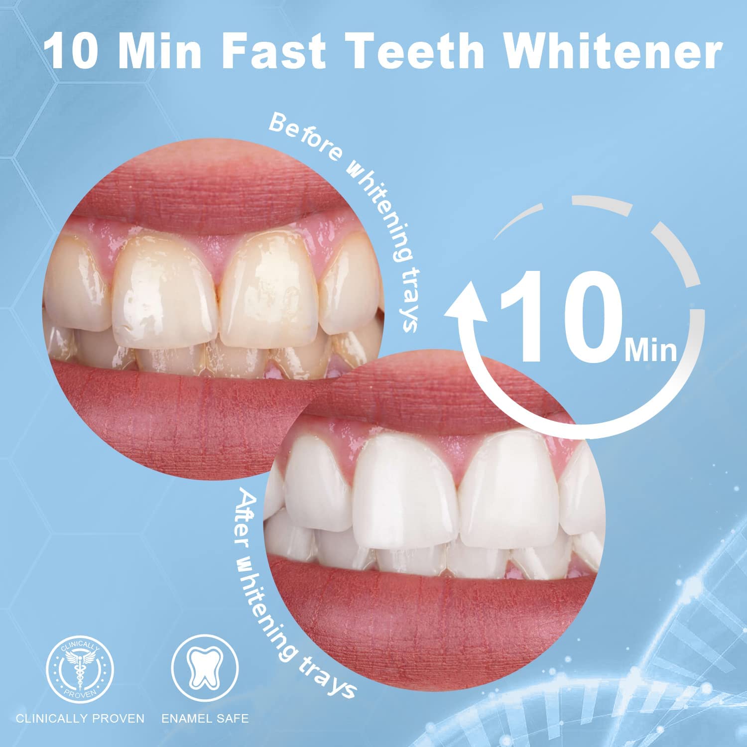 Special Offer MySmile® Teeth Whitening Kit w/ 28x LED Light Bundle X 2 - MySmile